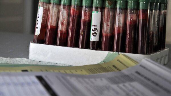 New online auction facility for farmers locked up with TB 
